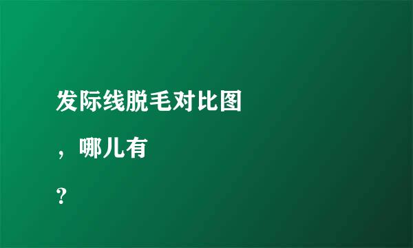 发际线脱毛对比图 
，哪儿有？