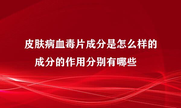 皮肤病血毒片成分是怎么样的 成分的作用分别有哪些