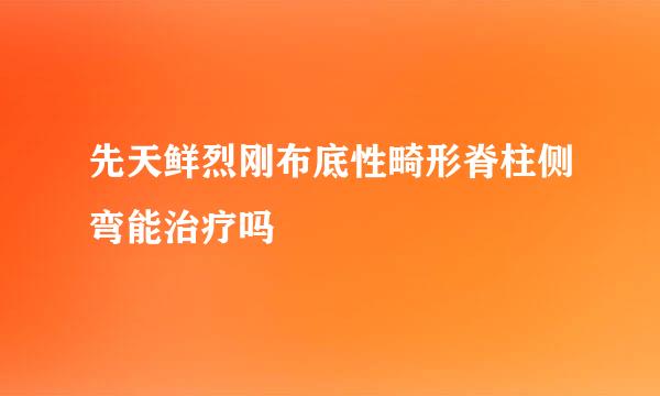 先天鲜烈刚布底性畸形脊柱侧弯能治疗吗