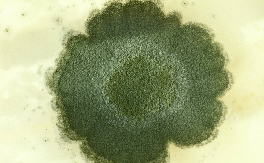 盘尼西林是什么?