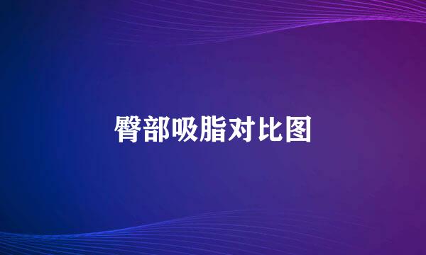 臀部吸脂对比图