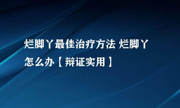 烂脚丫最佳治疗方法 烂脚丫怎么办【辩证实用】