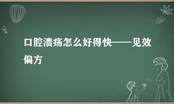 口腔溃疡怎么好得快——见效偏方