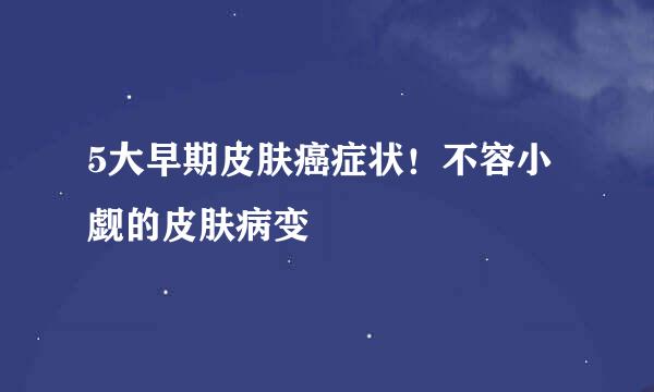 5大早期皮肤癌症状！不容小觑的皮肤病变