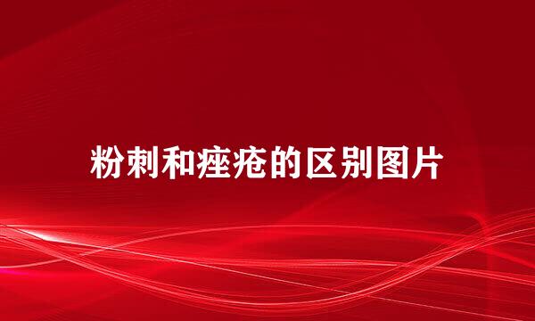 粉刺和痤疮的区别图片