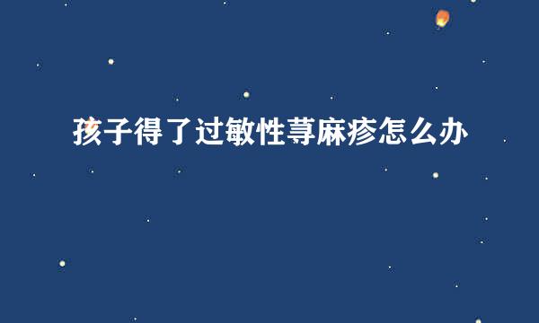 孩子得了过敏性荨麻疹怎么办