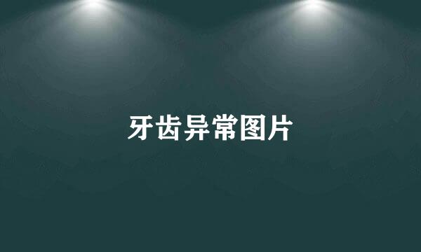 牙齿异常图片