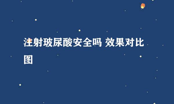 注射玻尿酸安全吗 效果对比图