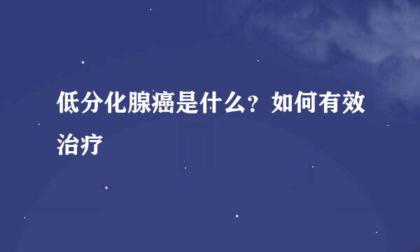 低分化腺癌是什么？如何有效治疗