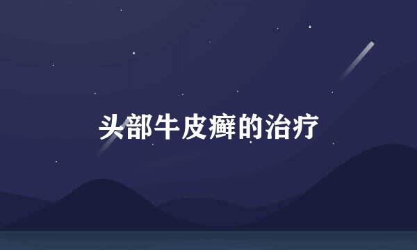 头部牛皮癣的治疗