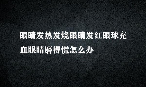 眼睛发热发烧眼睛发红眼球充血眼睛磨得慌怎么办
