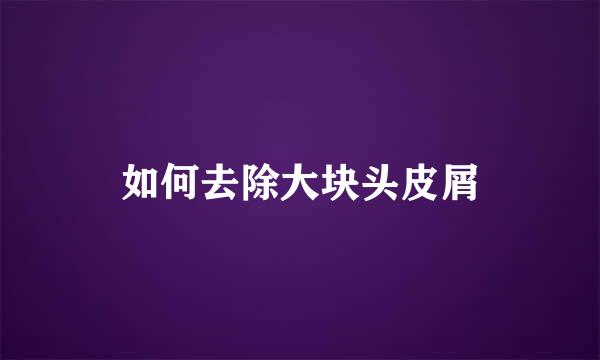 如何去除大块头皮屑