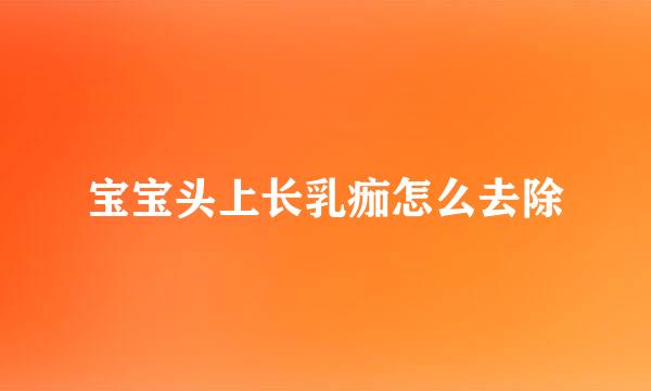 宝宝头上长乳痂怎么去除