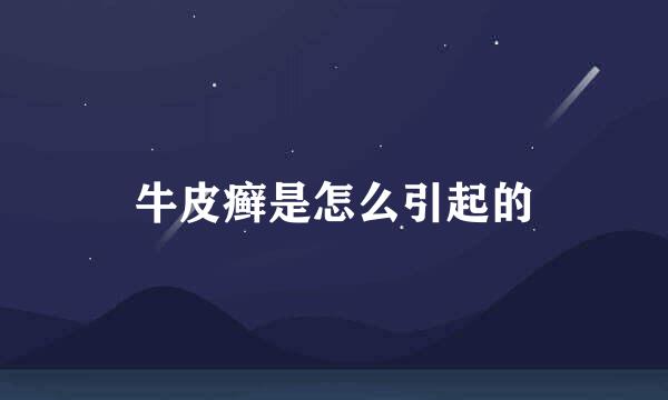 牛皮癣是怎么引起的