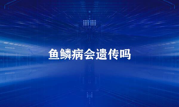 鱼鳞病会遗传吗