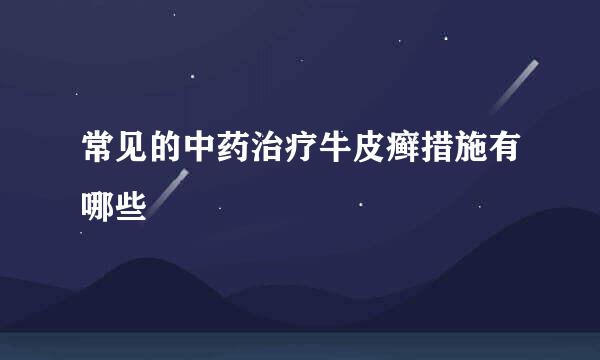 常见的中药治疗牛皮癣措施有哪些