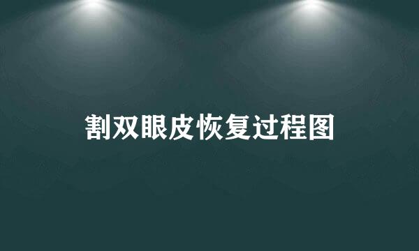割双眼皮恢复过程图