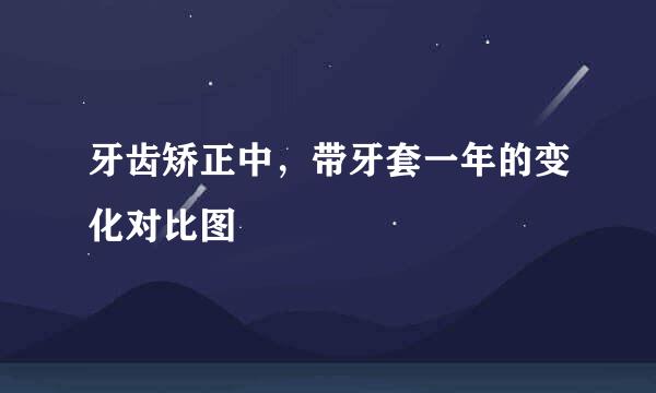 牙齿矫正中，带牙套一年的变化对比图