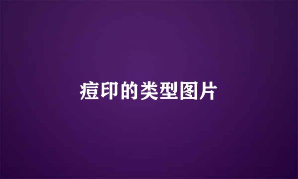 痘印的类型图片