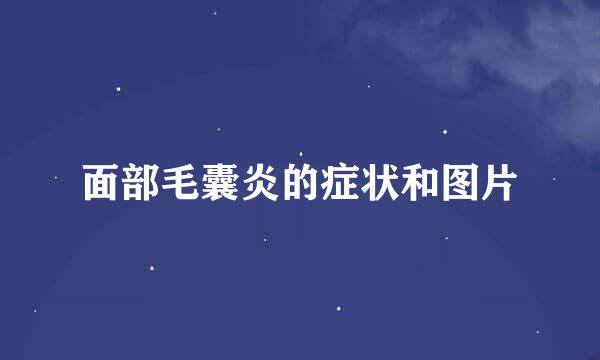 面部毛囊炎的症状和图片