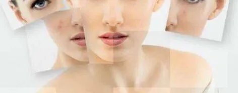 去粉刺大概需要多少钱