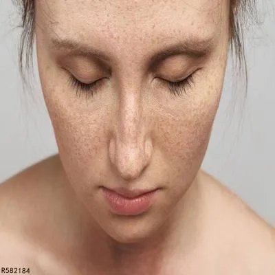 西红柿如何祛斑