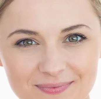 面部激光祛斑的效果