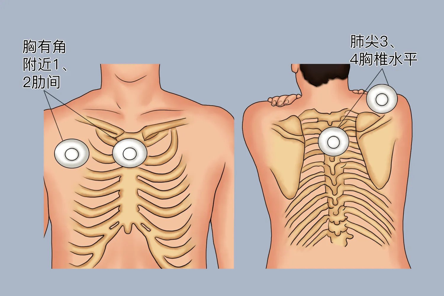 正常呼吸音的听诊部位示意图