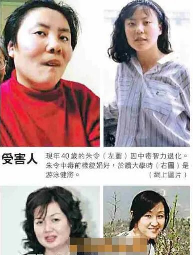 清华大学生铊中毒现在怎样了 清华铊中毒案凶手是谁?