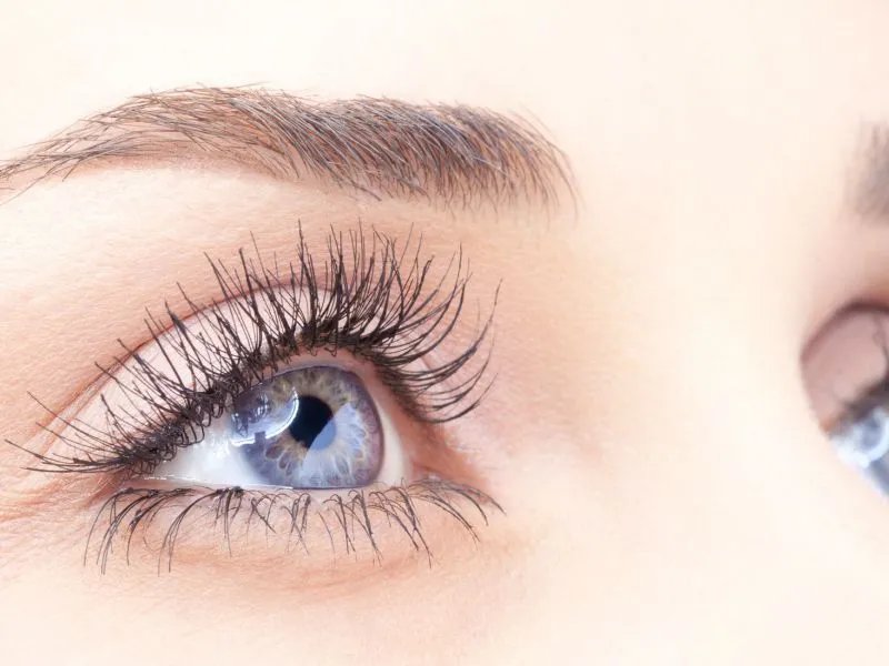 去鱼尾纹手术的步骤