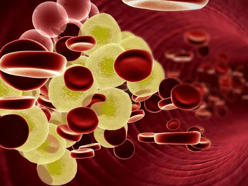 什么是brenneman综合征