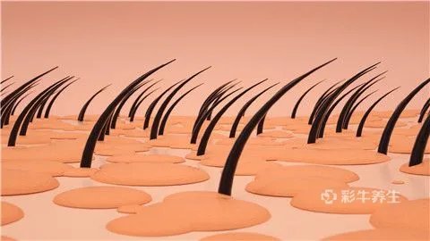 脂溢性脱发如何生发