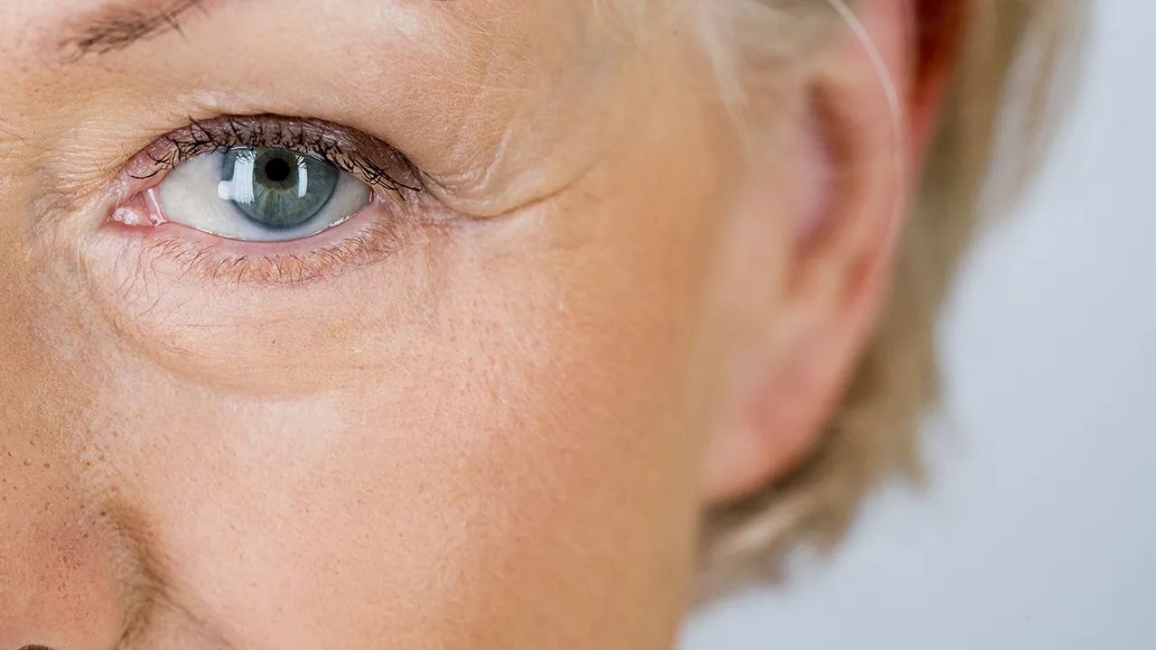 如何快速去除鱼尾纹