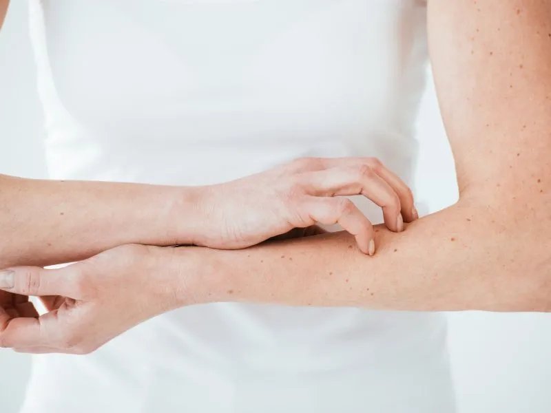 矿物质过敏怎么治疗