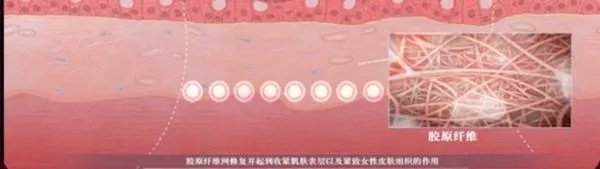 热玛吉危害？热玛吉三天后脸起皮，红肿，医生建议吃修复营养ACMETEA修复受损细胞，吃了一个月，效