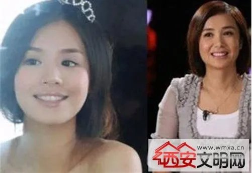 马思纯整容前后:被人感叹惊为天人