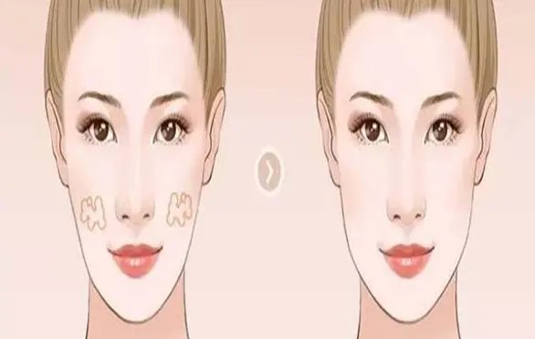 苏州做丰额头到哪个医院好？