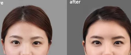 苏州做丰额头到哪个医院好？