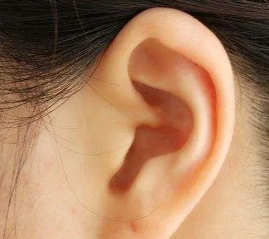 隐耳整形价格是多少