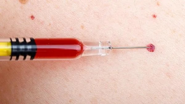 排便时出血、疼痛怎么回事