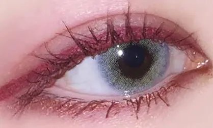 三点定位双眼皮价格多少