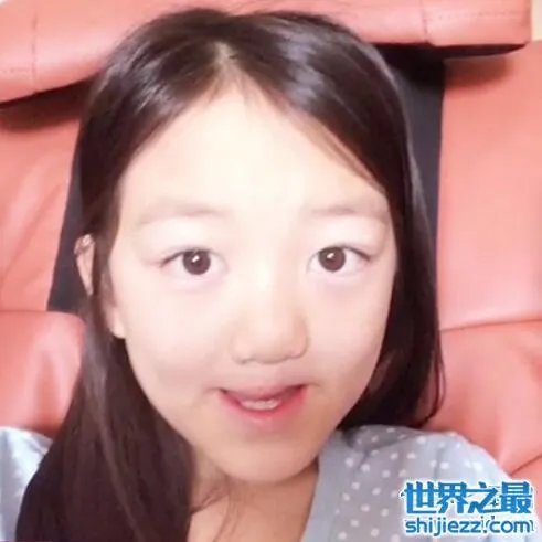 王菲李亚鹏女儿李嫣照片，天生唇腭裂却自信可爱 