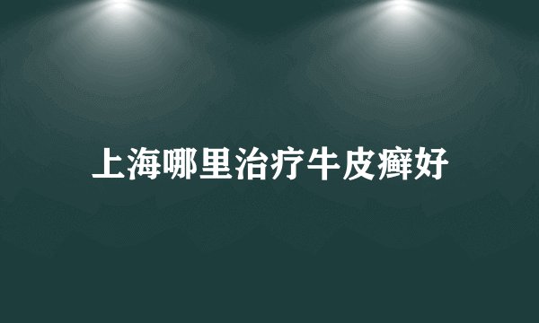 上海哪里治疗牛皮癣好