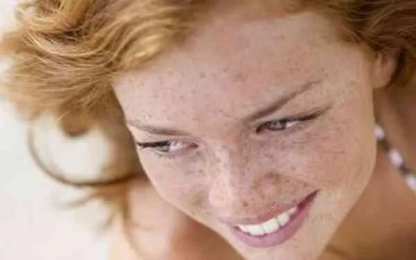 重庆祛斑费用大概是多少啊