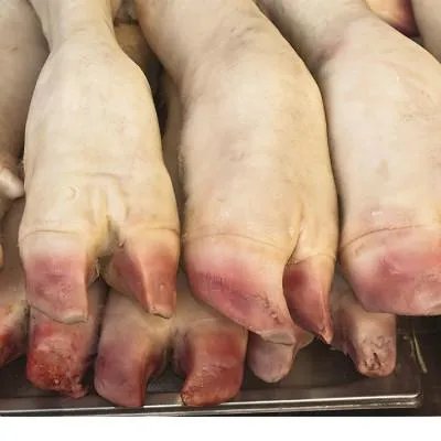 突发肾结石怎么办