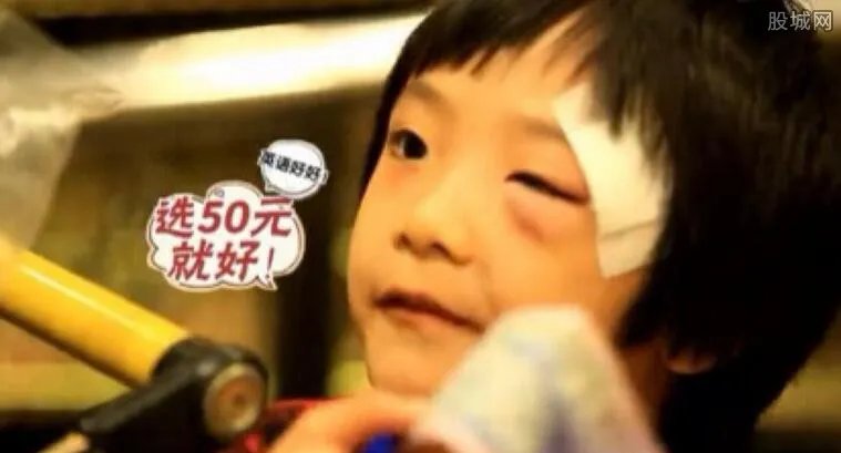 费曼怎么受伤的 费曼眼部受伤的真正原因