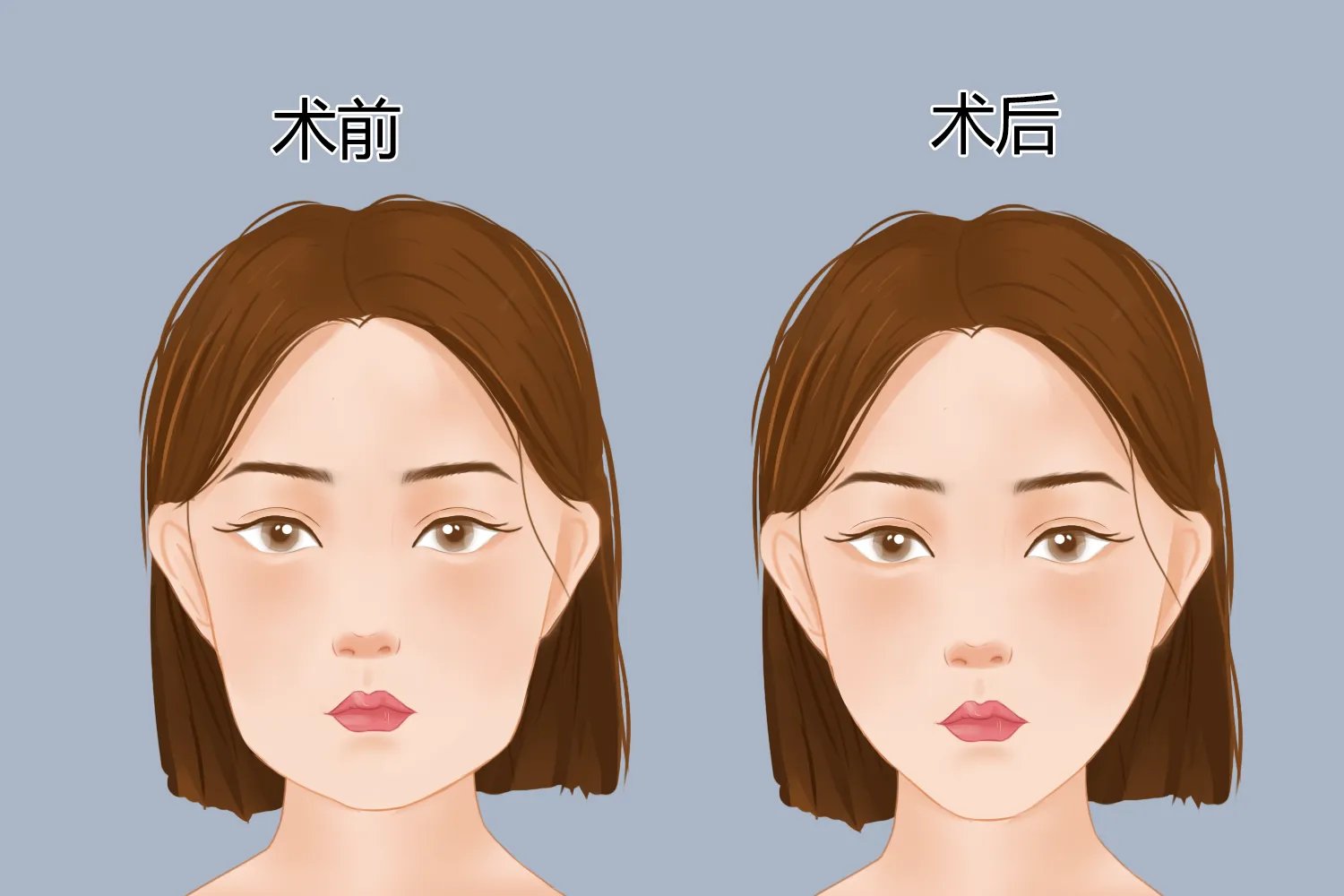 面部整形部位图解