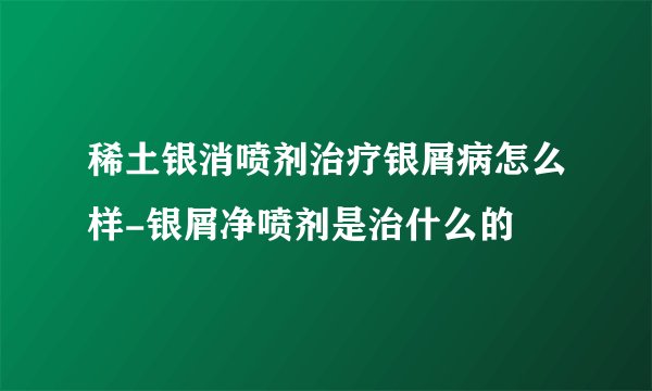 稀土银消喷剂治疗银屑病怎么样-银屑净喷剂是治什么的