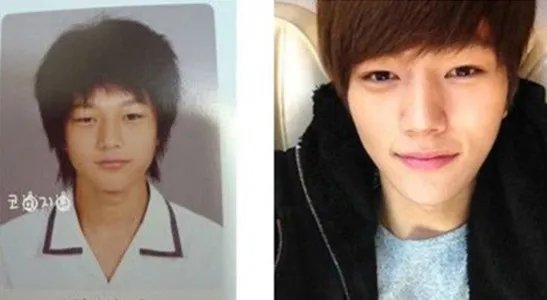 金明洙整容前后对比照 网友直呼认不出了