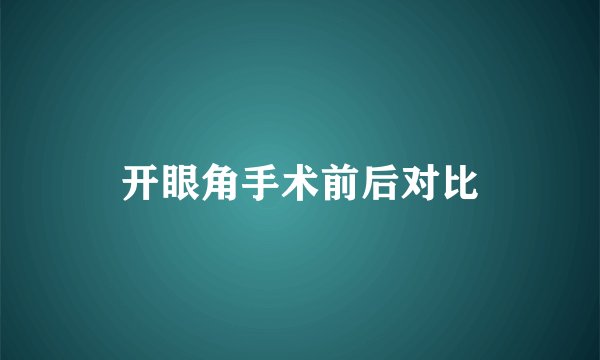 开眼角手术前后对比